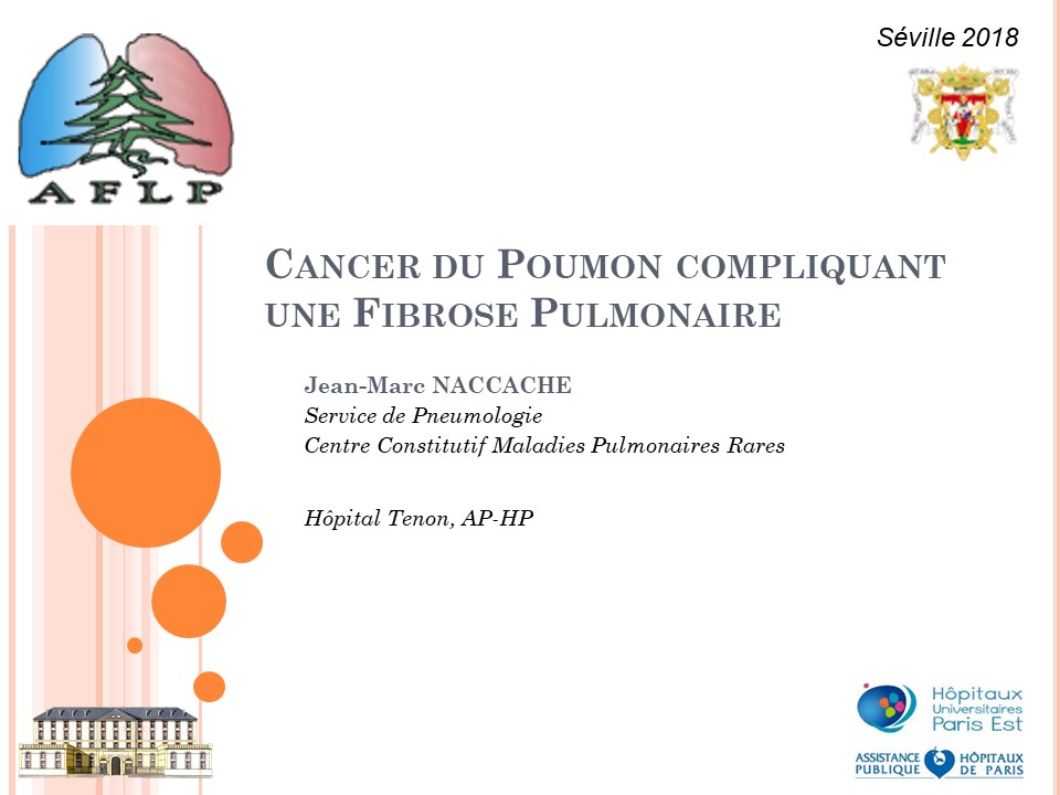 Cancer du poumon compliquant une fibrose pulmonaire. Jean Marc Naccache