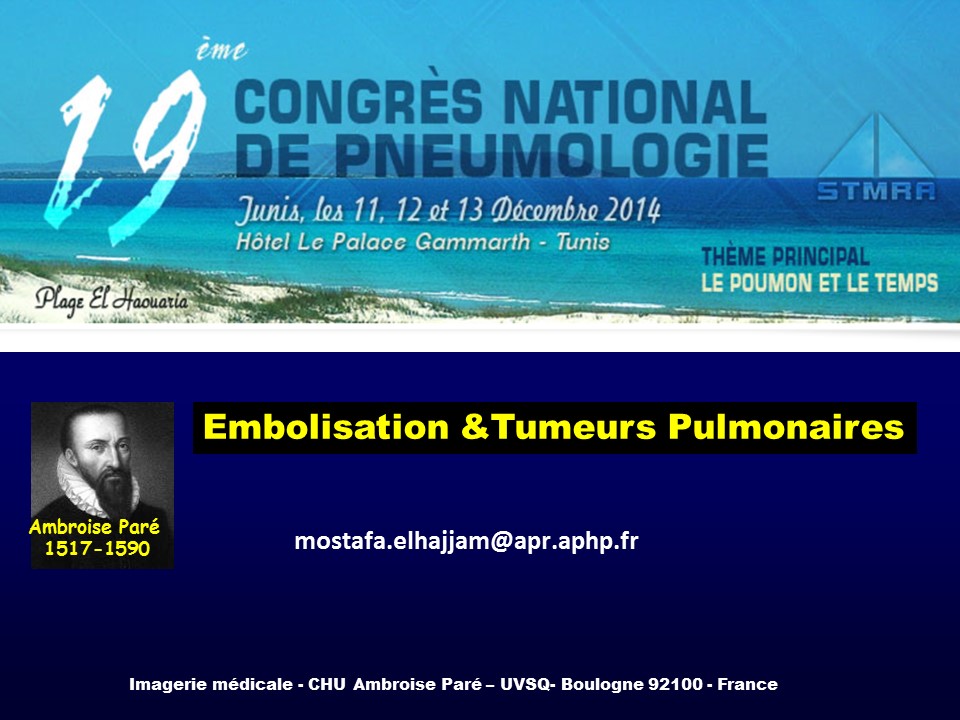 Embolisation & Tumeurs Pulmonaires. Mostafa El Hajjem