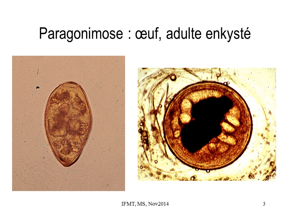 Paragonimose. M. Strobel