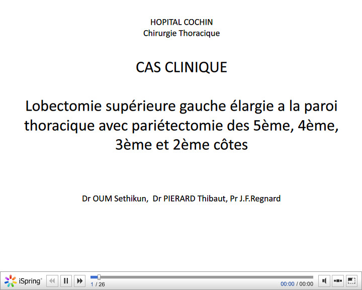 Cas clinique. Lobectomie supérieure gauche élargie a la paroi thoracique avec pariÃ©tectomie des 5ème, 4ème, 3ème et 2ème côtes