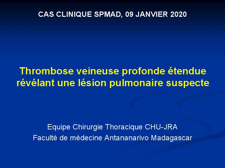 Thrombose veineuse profonde étendue révélant une lésion pulmonaire suspecte