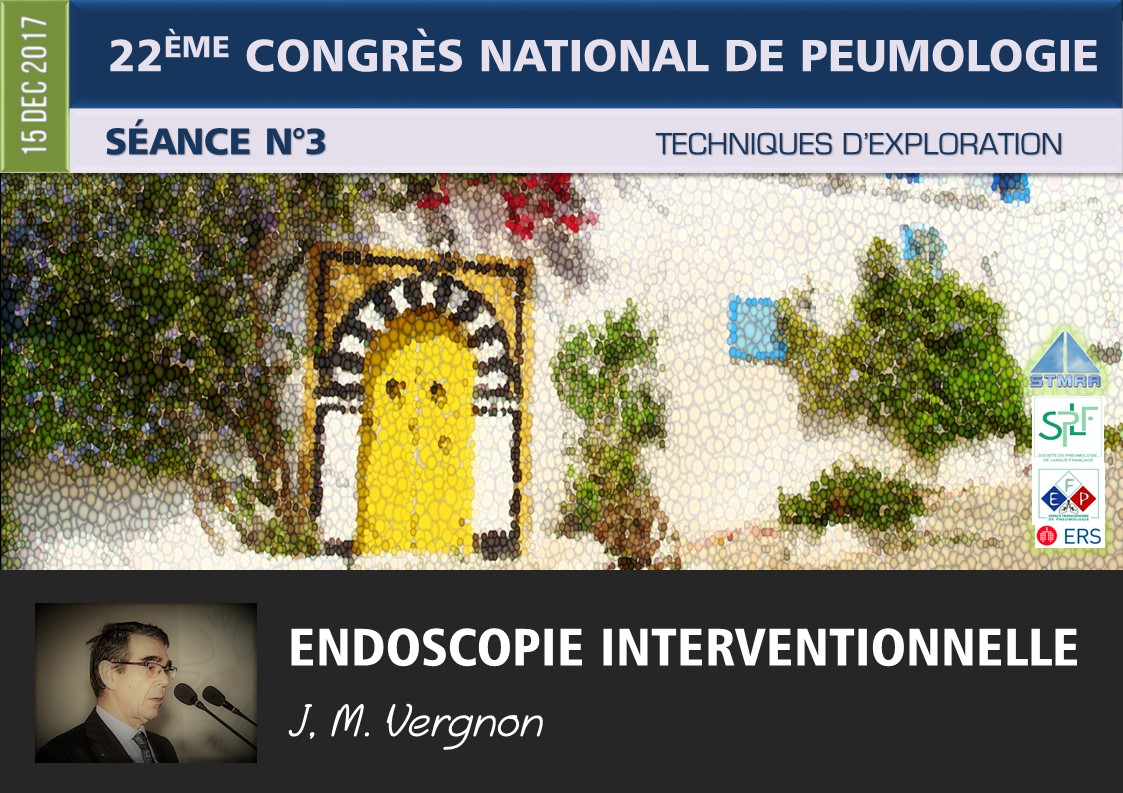 Bronchoscopie interventionnelle. JM Vergnon