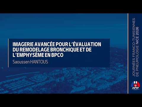 Imagerie avancée (scanner quantitatif, IA) pour l’évaluation du remodelage bronchique et de l’emphysème en BPCO. Saoussen HANTOUS