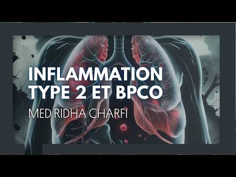 Inflammation type 2 et BPCO. Mohamed Ridha Charfi