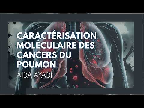 Caractérisation moléculaire des cancers du poumon. Aida Ayadi